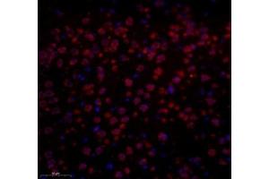 Immunofluorescence of paraffin embedded mouse prefrontal lobe using GPR137A (ABIN7073996) at dilution of 1: 650 (300x lens) (GPR137 antibody)