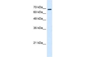 Western Blotting (WB) image for anti-Ras Homolog Gene Family, Member T1 (RHOT1) antibody (ABIN2463986) (RHOT1 antibody)