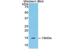 Western Blotting (WB) image for anti-Serpin Peptidase Inhibitor, Clade G (C1 Inhibitor), Member 1 (SERPING1) (AA 211-331) antibody (ABIN3208987)