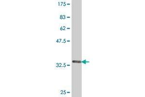 Western Blot detection against Immunogen (37. (Growth Hormone Receptor antibody  (AA 19-118))