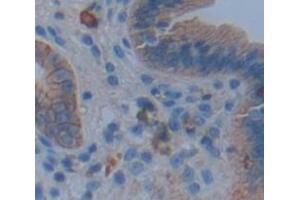 IHC-P analysis of Human Tissue, with DAB staining. (IL17RA antibody  (AA 33-172))