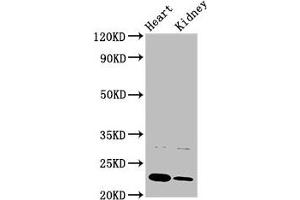 Western Blot Positive WB detected in: Rat heart tisue, Rat kidney tissue All lanes: PTPMT1 antibody at 3 μg/mL Secondary Goat polyclonal to rabbit IgG at 1/50000 dilution Predicted band size: 23, 16, 17 kDa Observed band size: 23 kDa (PTPMT1 antibody  (AA 28-201))