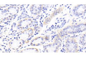 Detection of TNC in Human Stomach Tissue using Polyclonal Antibody to Tenascin C (TNC) (TNC antibody  (AA 49-181))