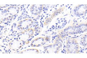 Detection of TNC in Human Stomach Tissue using Polyclonal Antibody to Tenascin C (TNC) (TNC antibody  (AA 49-181))