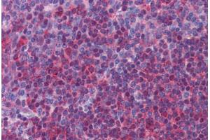 Human Tonsil: Formalin-Fixed, Paraffin-Embedded (FFPE) (ERK1/2 antibody)