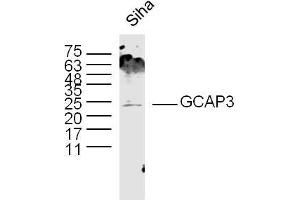 Siha lysates probed with GCAP3 Polyclonal Antibody, Unconjugated  at 1:300 dilution and 4˚C overnight incubation. (GUCA1C antibody  (AA 141-209))