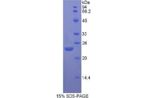 SDS-PAGE analysis of Rat FGF13 Protein. (FGF13 Protein)