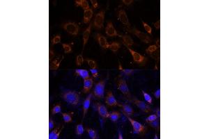 Immunofluorescence analysis of NIH-3T3 cells using VPS25 Polyclonal Antibody (ABIN6128913, ABIN6150122, ABIN6150123 and ABIN6217011) at dilution of 1:100 (40x lens).
