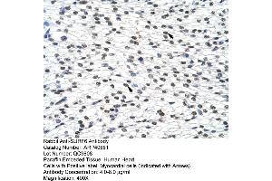 Rabbit Anti-SURF6 Antibody  Paraffin Embedded Tissue: Human Heart Cellular Data: Myocardial cells Antibody Concentration: 4. (SURF6 antibody  (Middle Region))