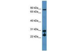 Image no. 1 for anti-Carbonic Anhydrase II (CA2) (AA 73-122) antibody (ABIN6746752) (CA2 antibody  (AA 73-122))