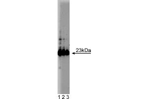 Western Blotting (WB) image for anti-Glutathione S-Transferase pi 1 (GSTP1) (AA 5-210) antibody (ABIN968135) (GSTP1 antibody  (AA 5-210))