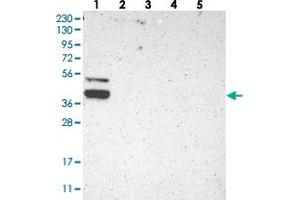 Western blot analysis of Lane 1: RT-4, Lane 2: U-251 MG, Lane 3: Human Plasma, Lane 4: Liver, Lane 5: Tonsil with KLHDC8B polyclonal antibody  at 1:250-1:500 dilution. (KLHDC8B antibody)