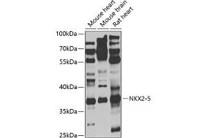 Western blot analysis of extracts of various cell lines, using NKX2-5 antibody (ABIN6132412, ABIN6144644, ABIN6144646 and ABIN6221293) at 1:1000 dilution. (NK2 Homeobox 5 antibody  (AA 1-135))