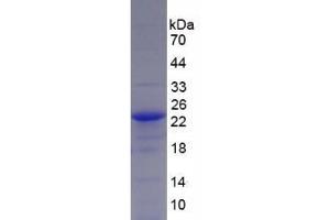 SDS-PAGE analysis of Human Glucose Transporter 1 Protein. (GLUT1 Protein)