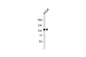 MER Antibody (ABIN392343 and ABIN2841983) western blot analysis in Jurkat cell line lysates (35 μg/lane).