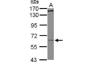 Western Blotting (WB) image for anti-Kinesin Family Member 19 (KIF19) (AA 88-344) antibody (ABIN1499036) (KIF19 antibody  (AA 88-344))