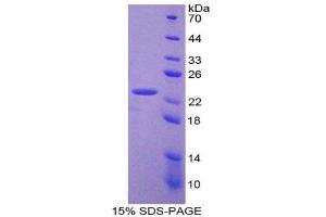 SDS-PAGE (SDS) image for Frataxin (FXN) (AA 41-207) protein (His tag) (ABIN2124876) (Frataxin Protein (FXN) (AA 41-207) (His tag))