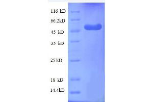 WD Repeat Domain 1 (WDR1) (AA 189-461), (partial) protein (GST tag) (WDR1 Protein (AA 189-461, partial) (GST tag))