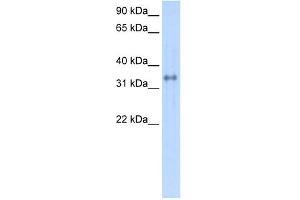 Carbonic Anhydrase IV antibody used at 1 ug/ml to detect target protein.
