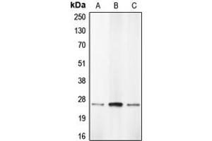 Western blot analysis of Caspase 1 expression in THP1 (A), HL60 (B), BAEC (C) whole cell lysates. (Caspase 1 antibody  (Center))