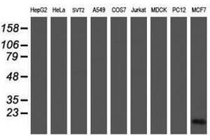 Image no. 2 for anti-Cellular Retinoic Acid Binding Protein 2 (CRABP2) antibody (ABIN1497621) (CRABP2 antibody)