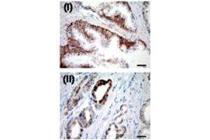 IHC for USP2a in a formalin-fixed, paraffin-embedded human prostate sample. (USP2 antibody  (N-Term))