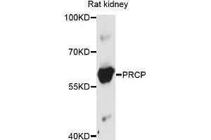 Western blot analysis of extract of rat kidney cells, using PRCP antibody. (PRCP antibody)