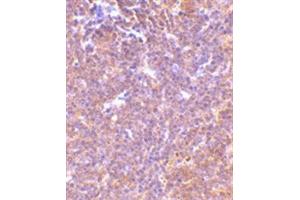 Image no. 1 for anti-P21-Activated Kinase 2 (PAK2) (C-Term) antibody (ABIN318772) (PAK2 antibody  (C-Term))