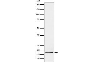 Western blot analysis of GCDFP 15 expression in T47D cell lysate.