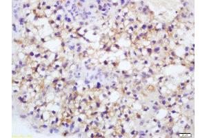 Formalin-fixed and paraffin embedded mouse placenta labeled with Rabbit Anti-Endothelial Lipase Polyclonal Antibody, Unconjugated  at 1:200 followed by conjugation to the secondary antibody and DAB staining (LIPG antibody  (AA 1-500))