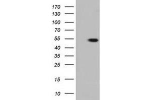 HEK293T cells were transfected with the pCMV6-ENTRY control (Left lane) or pCMV6-ENTRY TUBA3E (Right lane) cDNA for 48 hrs and lysed. (TUBA3E antibody)