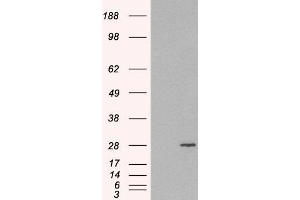 HEK293 overexpressing RAB11A(ABIN5362200) and probed with ABIN184807 (mock transfection in first lane). (RAB11A antibody  (C-Term))