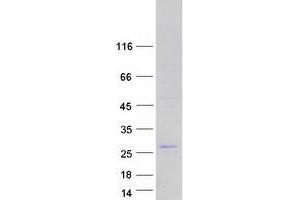 Validation with Western Blot