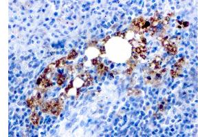 Formalin-fixed, paraffin-embedded human Spleen stained with TRAcP Mouse Recombinant Monoclonal Antibody (rACP5/1070). (Recombinant ACP5 antibody)