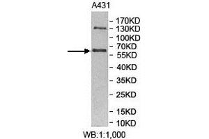 Western Blotting (WB) image for anti-Makorin Ring Finger Protein 3 (MKRN3) antibody (ABIN1855943) (MKRN3 antibody)