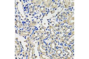 Immunohistochemistry of paraffin-embedded mouse kidney using SCG3 antibody. (SCG3 antibody  (AA 199-468))