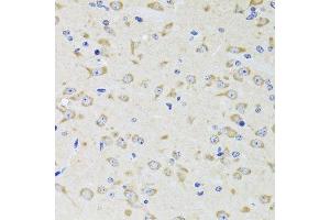 Immunohistochemistry of paraffin-embedded rat brain using YWHAZ antibody. (14-3-3 zeta antibody  (AA 1-100))