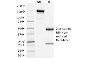 SDS-PAGE Analysis of Purified Clathrin, LC Mouse Monoclonal Antibody (CLC/1421). (CLTA/CLTB antibody  (N-Term))