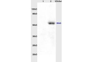 Lane 1: rat brain lysates Lane 2: human colon carcinoma lysates probed with Anti AVPR2 Polyclonal Antibody, Unconjugated (ABIN731468) at 1:200 in 4 °C. (MCTS1 antibody  (C-Term))