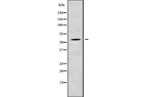 Western blot analysis of RPS6KL1 using LOVO whole cell lysates