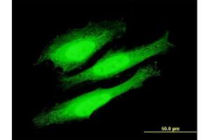 Immunofluorescence of purified MaxPab antibody to KIAA1967 on HeLa cell. (CCAR2 antibody  (AA 1-923))