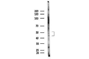 anti-NIMA (Never in Mitosis Gene A)-Related Kinase 2 (NEK2) (Internal Region) antibody