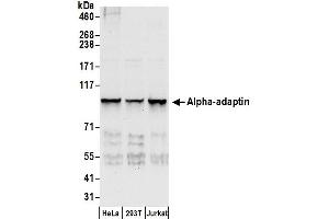 Western Blotting (WB) image for anti-Adaptor-Related Protein Complex 2, alpha 1 Subunit (AP2A1) (AA 600-650) antibody (ABIN7449957)