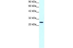Human Jurkat; WB Suggested Anti-CLDN13 Antibody Titration: 1. (Claudin 13 (CLDN13) (C-Term) antibody)