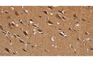 Immunohistochemistry of paraffin-embedded Human brain using NDUFS1 Polyclonal Antibody at dilution of 1:50 (NDUFS1 antibody)