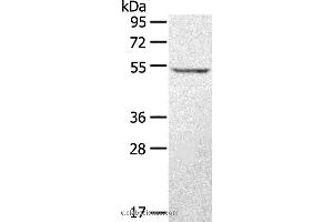 Western blot analysis of A431 cell, using STYK1 Polyclonal Antibody at dilution of 1:500 (STYK1 antibody)