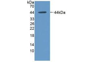 Western blot analysis of recombinant Rat HK1. (Hexokinase 1 antibody  (AA 413-540))