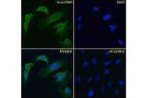Immunofluorescence (IF) image for anti-Fibrillin 1 (FBN1) (Internal Region) antibody (ABIN570798)