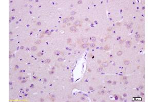 Formalin-fixed and paraffin embedded rat brain labeled with Rabbit Anti LGI1/ETL1 Polyclonal Antibody, Unconjugated (ABIN720430) at 1:200 followed by conjugation to the secondary antibody and DAB staining (LGI1 antibody  (AA 451-557))