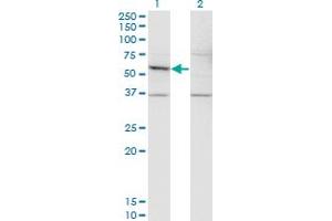 Western Blot analysis of DFNA5 expression in transfected 293T cell line by DFNA5 monoclonal antibody (M01), clone 1E10. (DFNA5 antibody  (AA 111-200))